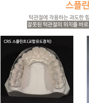 턱통증 치료, 비수술로 해결하는 방법 관련 이미지 7