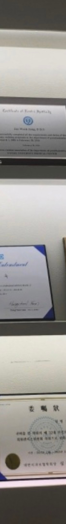 투명교정치료 일반적인 과정과 차이점은? 장점을 알아보자 관련 이미지 16