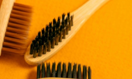 어린이 주걱턱 교정, 나이, 치료하는 이유 함께 알아봐요 관련 이미지 8