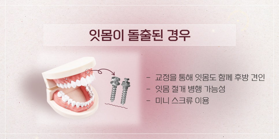 잇몸이 돌출되었을 때 해결방법 (잇몸돌출교정) 관련 이미지 5