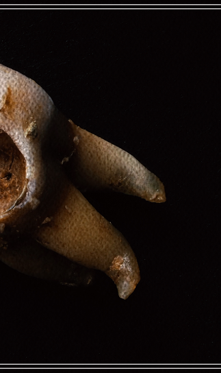 탕후루 충치, 치아 건강에 치명적? 관련 이미지 3