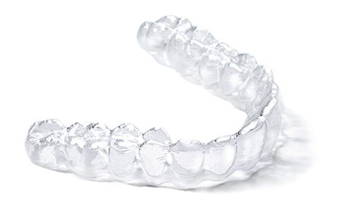 투명교정장치 다시 알아보기 (5) 디디하임 관련 이미지 1