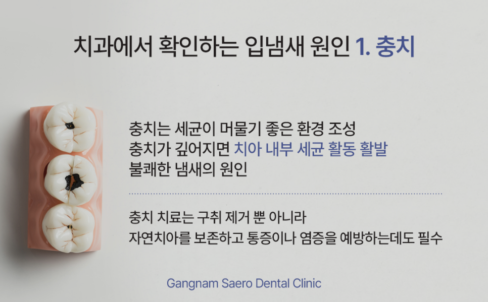 입냄새 치과에서 확인해야 할 몇 가지 (입냄새원인) 관련 이미지 3