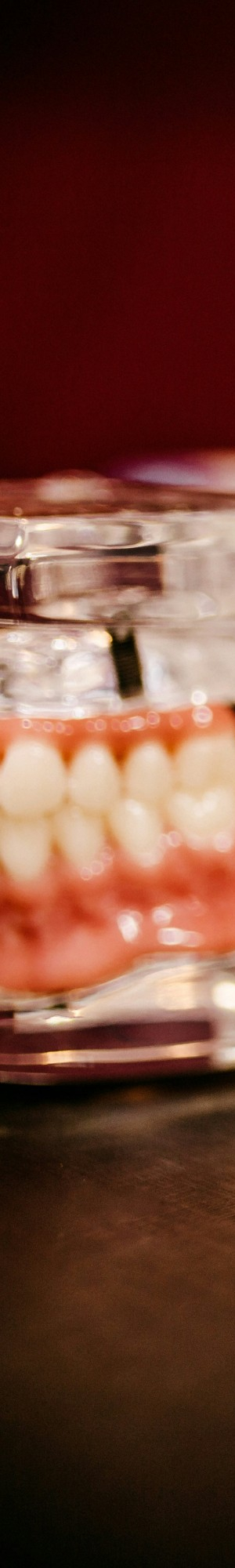 임플란트 식립이 불가능할 수도 있는 건강 상태 알아보기. 관련 이미지 5