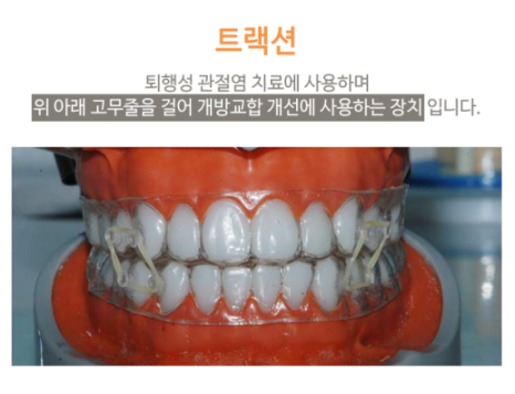 강남턱관절치과, 비수술 턱통증치료 궁금하다면 필독 관련 이미지 12