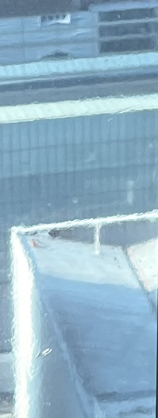 발치 후 교정, 이빨을 뽑지 않는 치료 방법이 있다? 관련 이미지 15