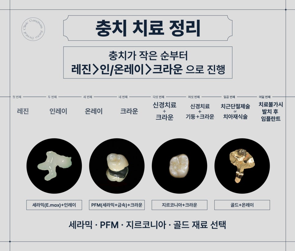 발치 전 최후의 수단 자연치아보존 (치근단절제술) 관련 이미지 3