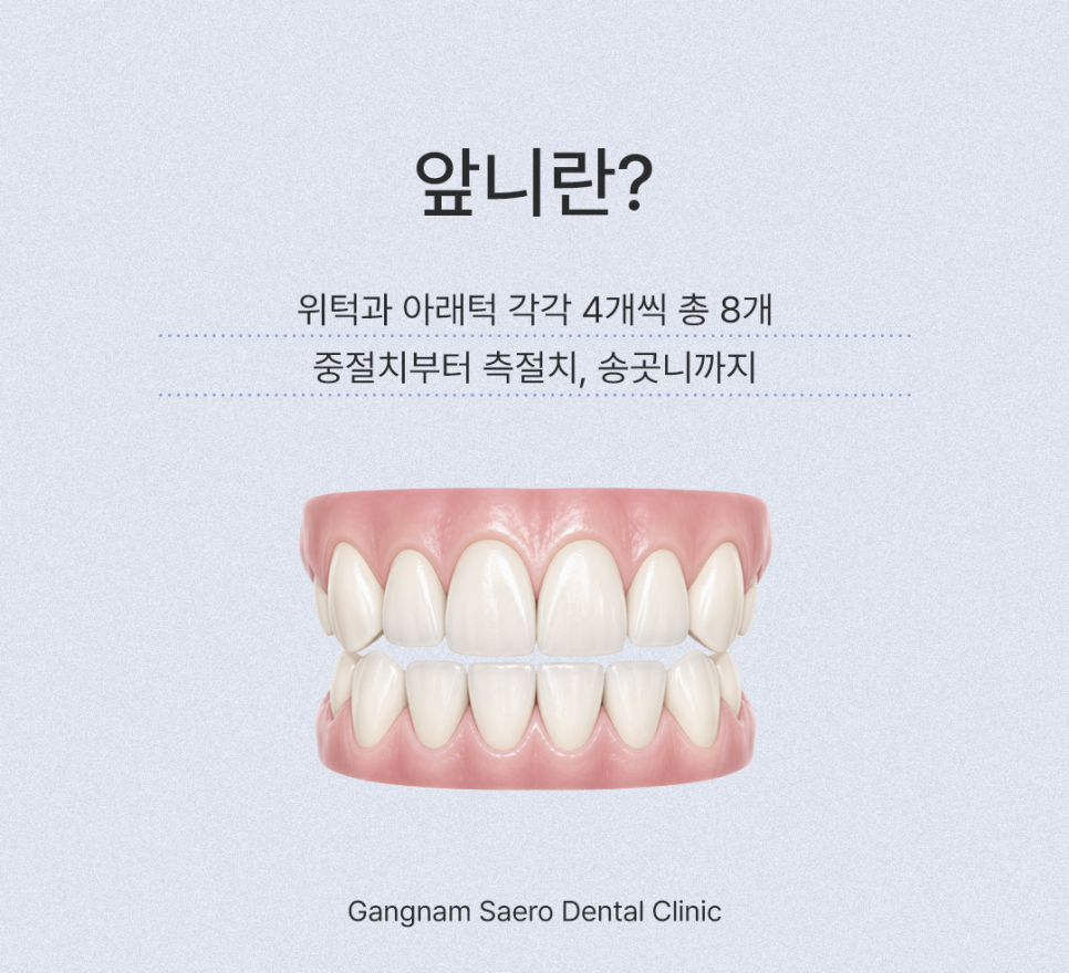 앞니깨졌을때, 깨진앞니 치료하는 여러 가지 방법 레진 / 라미네이트 / 크라운 / 임플란트 관련 이미지 2