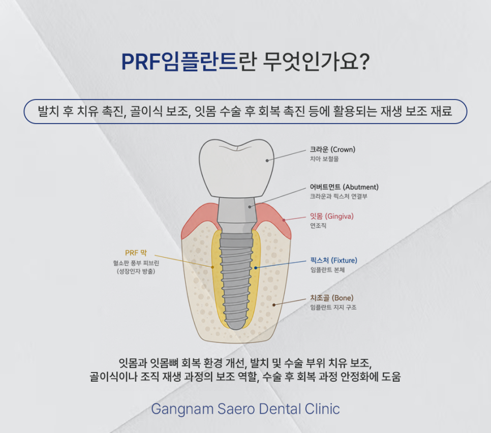 Can You Get Dental Implants Even If You Have High Blood Pressure? (PRF Implants) image 6