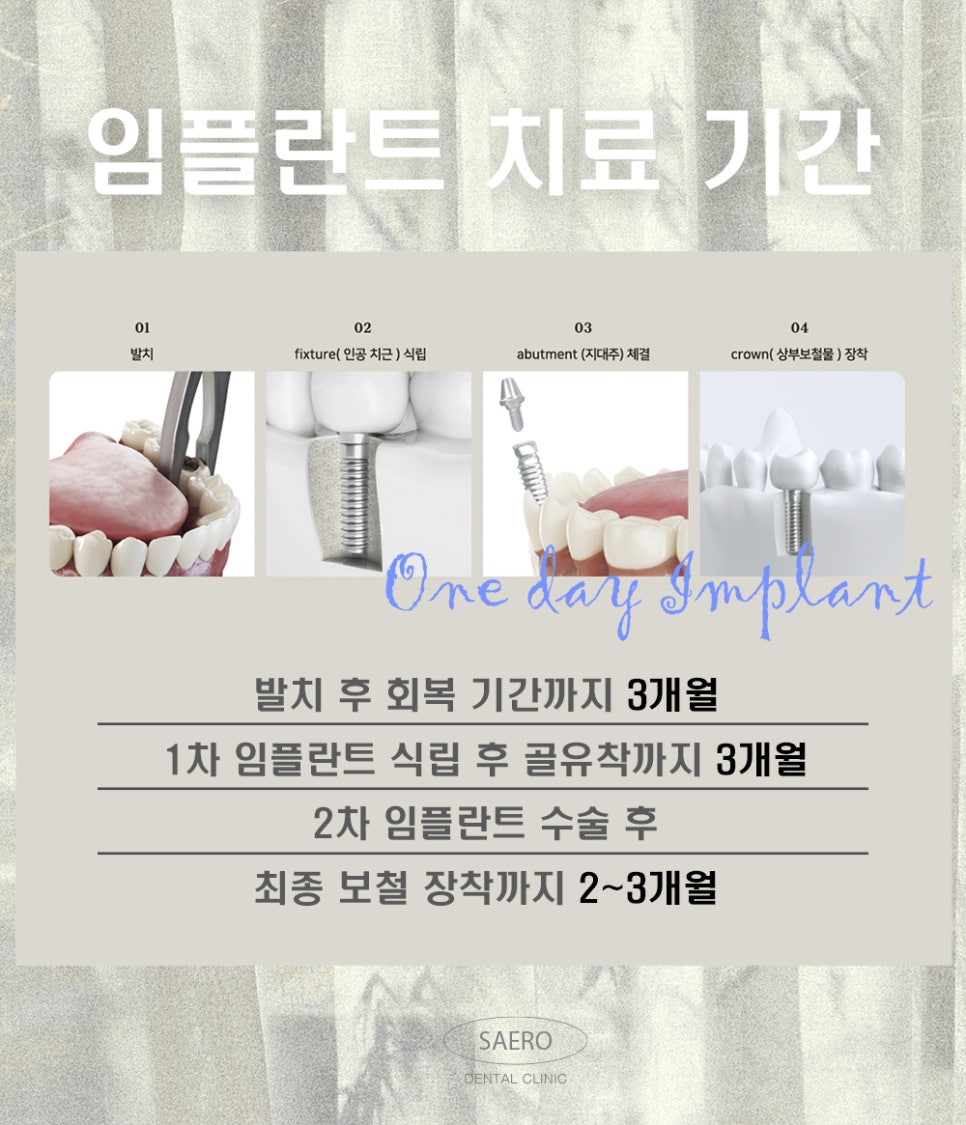 발치부터 임플란트까지 6개월 단축 (원데이임플란트) 관련 이미지 2