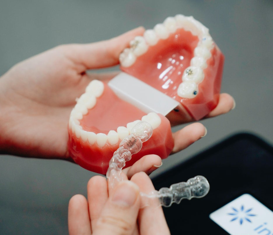 치아 교정을 받고 싶은 분들 주목! 치료 시기와 기간 알려드립니다! 관련 이미지 4