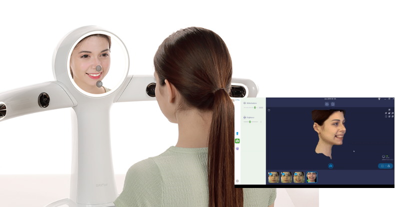 안전한 윗니 임플란트 (상악동거상술) 관련 이미지 4