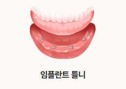 Combining the Advantages of Implants and Dentures (Implant Denture) image 4