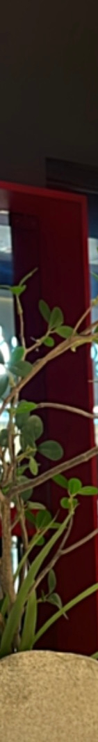 라미네이트재부착 가능할까? 보철물 파절 원인 및 대처 방법 관련 이미지 13