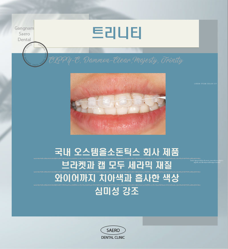 자가결찰교정과 클리피씨의 차이? (자가결찰교정 종류) 관련 이미지 6