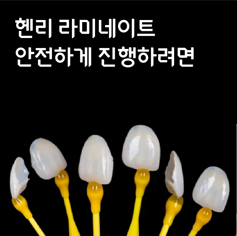 법랑질 삭제를 최소로 하는 헨리라미네이트 관련 이미지 2