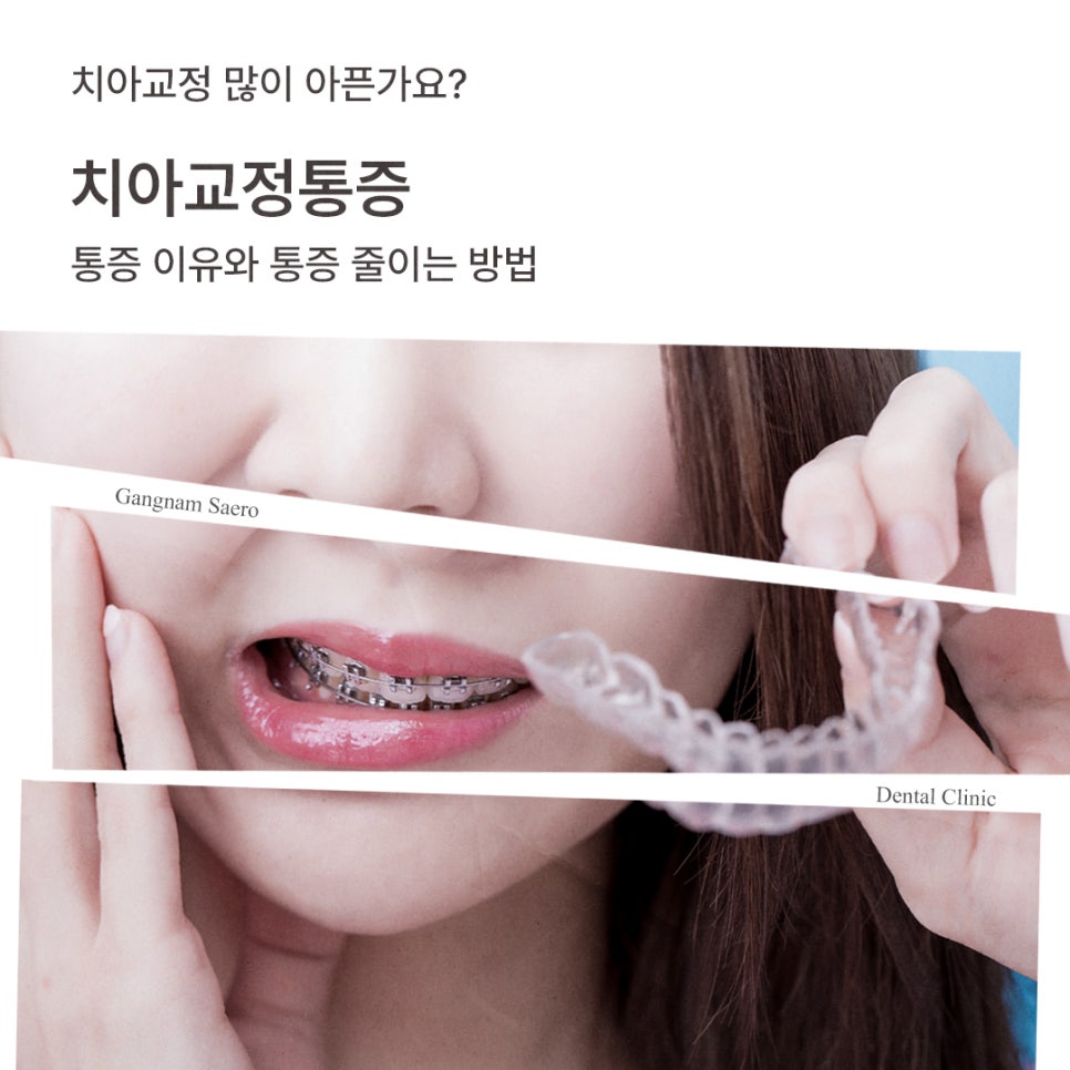 치아교정 많이 아픈가요? 통증 이유와 줄이는 방법 (치아교정통증) 관련 이미지 1