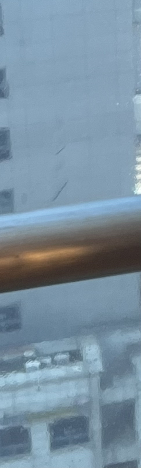 발치 후 교정, 이빨을 뽑지 않는 치료 방법이 있다? 관련 이미지 10