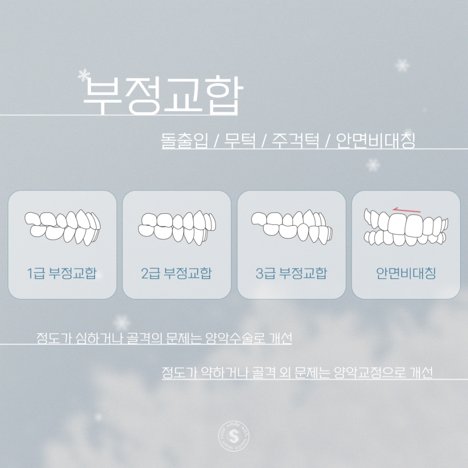 부정교합 앞니 잇몸 치과에서 교정하기 (성형없이예뻐지는방법) 관련 이미지 2