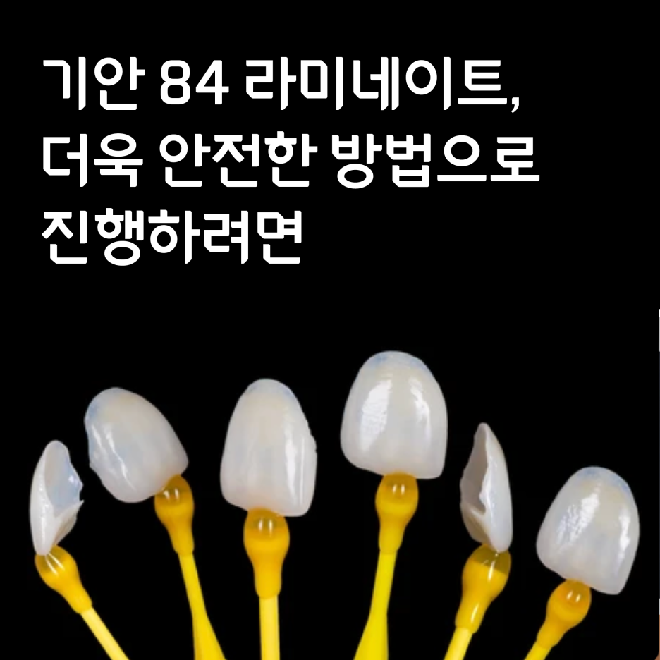 기안라미네이트 치아 손상 걱정없이 보다 안전한 진행 방법? 관련 이미지 2
