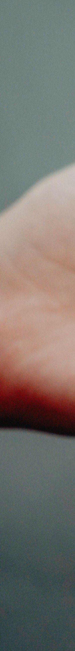 성인치아교정 치료, 부정교합, 구강 건강 개선이 될까요? 고민하고 계시다면 궁금증 타파해드립니다! 관련 이미지 5