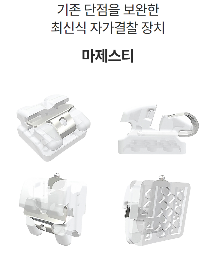 오스템 대표 최신식 자가결찰교정장치 (오스템교정) 관련 이미지 2