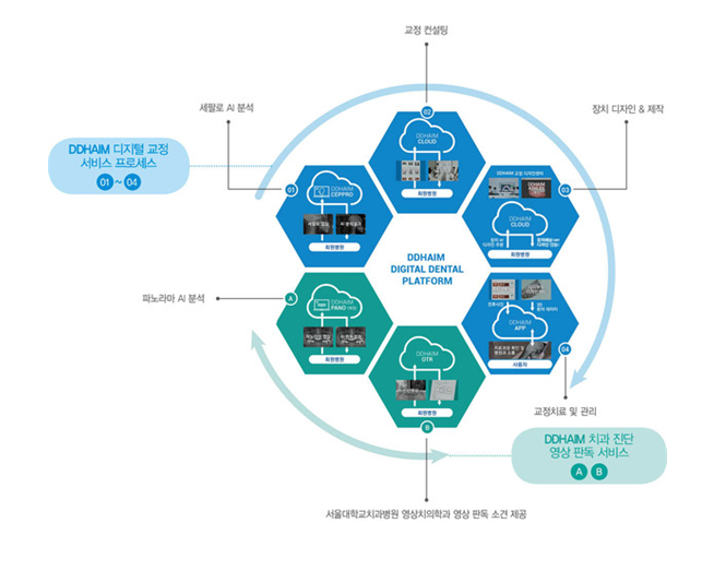 투명교정종류 자세히 알아보기 (5) 디디하임 관련 이미지 4