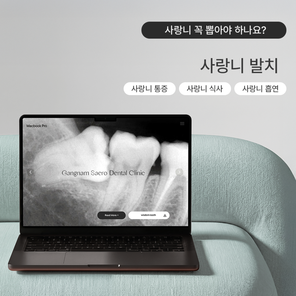 사랑니발치, 꼭 뽑아야 하나요? 통증 식사 흡연 안내 관련 이미지 1