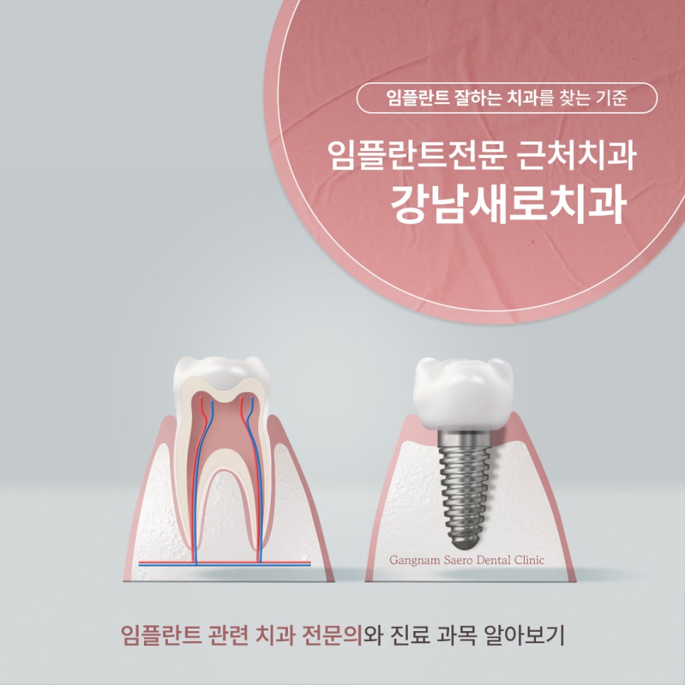 임플란트 잘하는 치과 기준 (임플란트전문 근처치과 강남새로치과) 관련 이미지 1