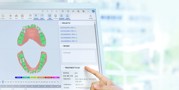 투명교정장치 다시 알아보기 (3) 매직얼라인 관련 이미지 2