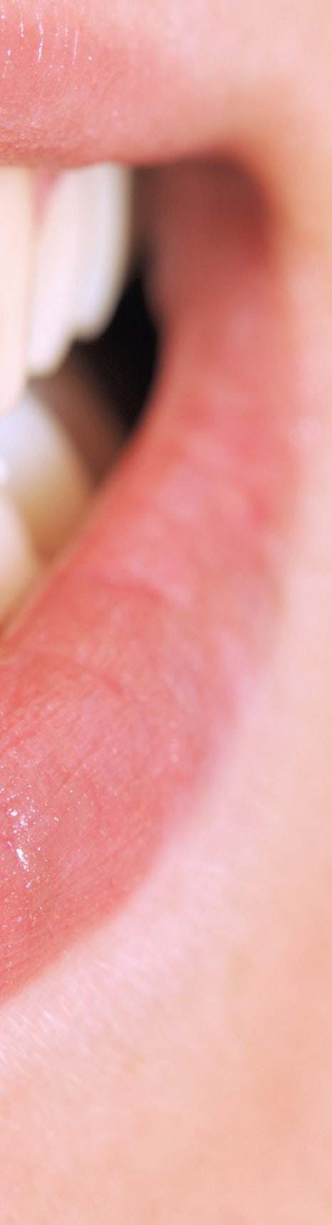 부정교합 교정치료, 비발치로 진행하려면? 관련 이미지 9