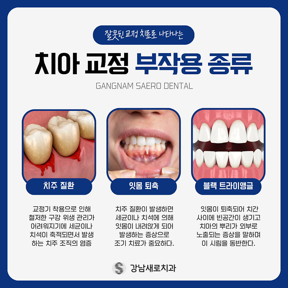 치아 교정 후 부작용이 발생하는 원인? 관련 이미지 5