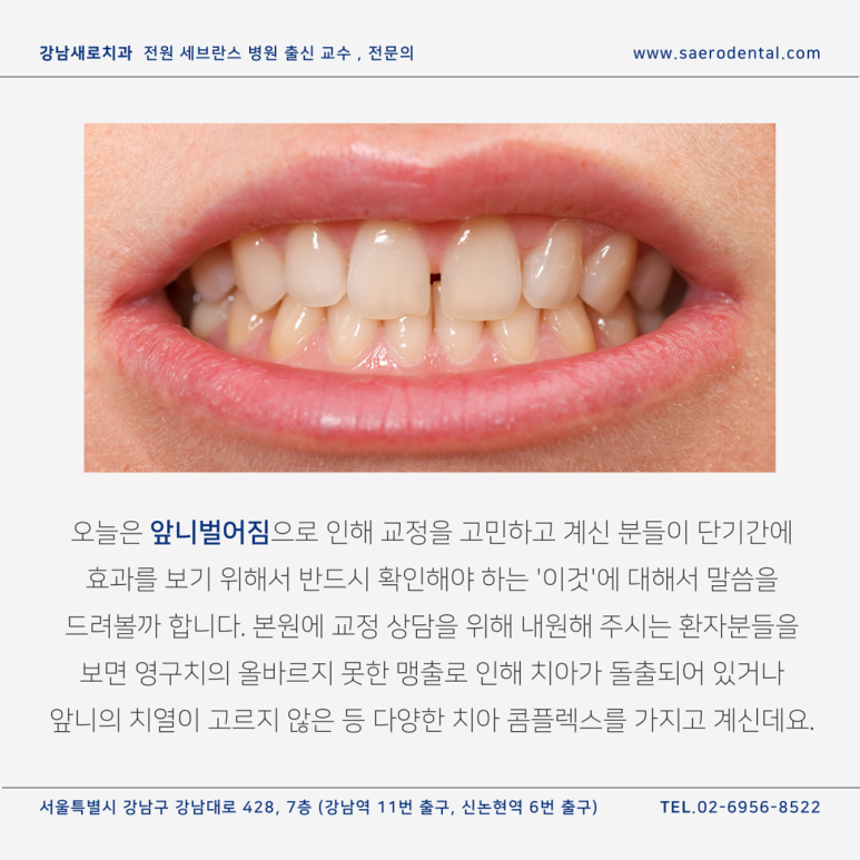 벌어진 앞니 교정으로 단기간에 개선하려면? 관련 이미지 1
