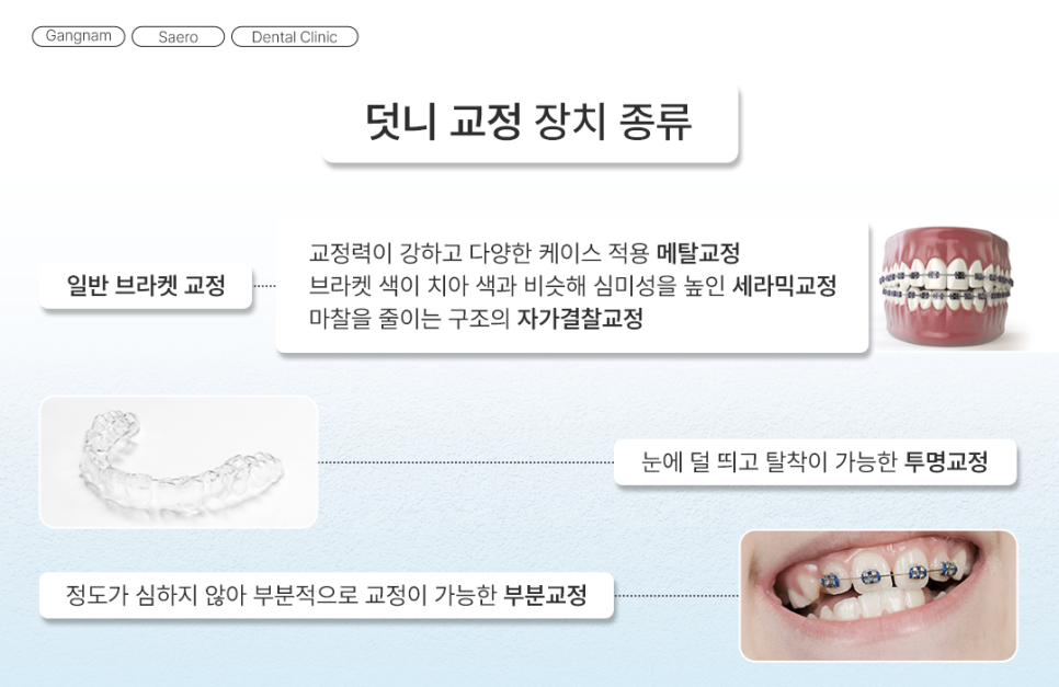 삐뚤어진 치아를 가지런하게 기능과 심미 회복 (덧니교정) 관련 이미지 8