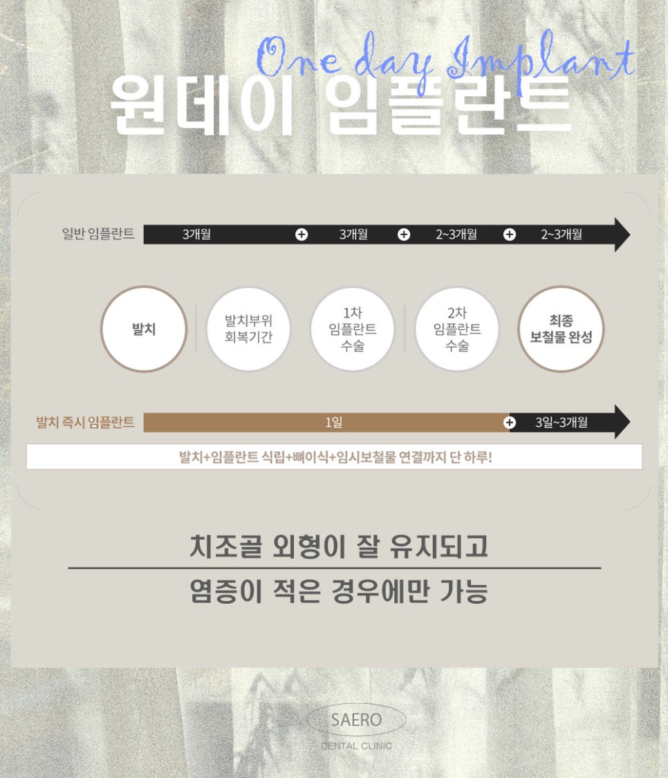 발치부터 임플란트까지 6개월 단축 (원데이임플란트) 관련 이미지 3