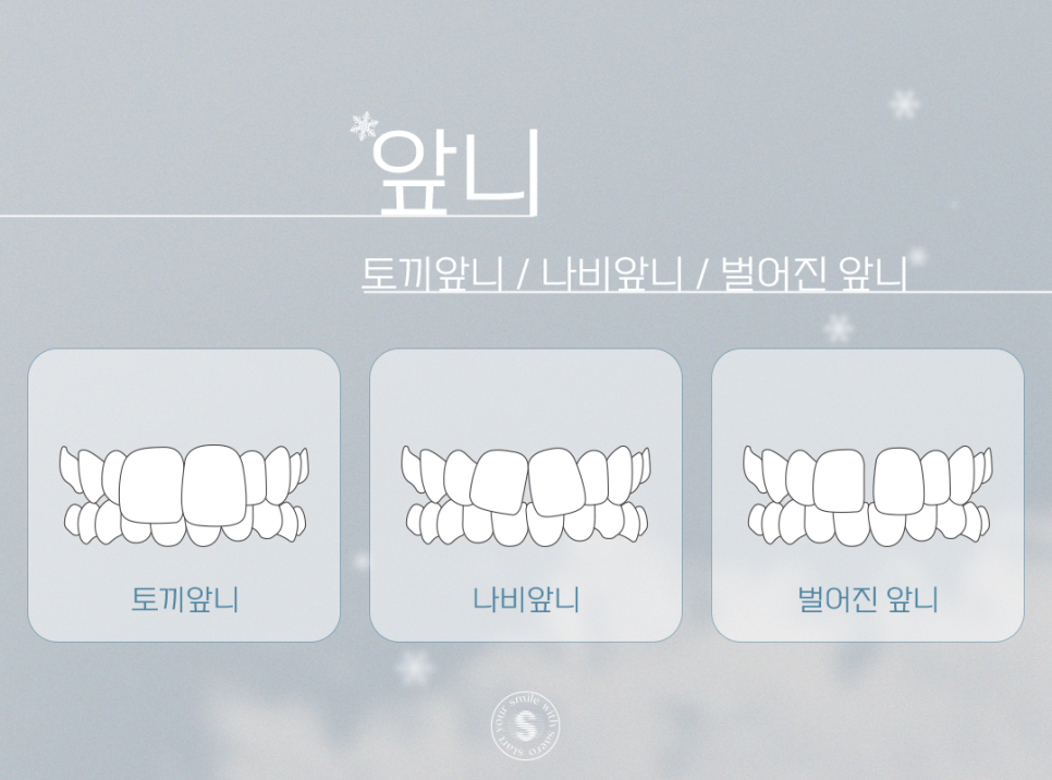 부정교합 앞니 잇몸 치과에서 교정하기 (성형없이예뻐지는방법) 관련 이미지 4