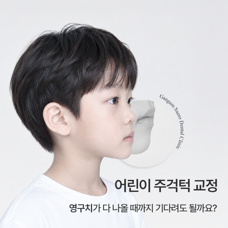 어린이 주걱턱, 영구치가 다 나올 때까지 기다려도 될까요? 관련 이미지 1