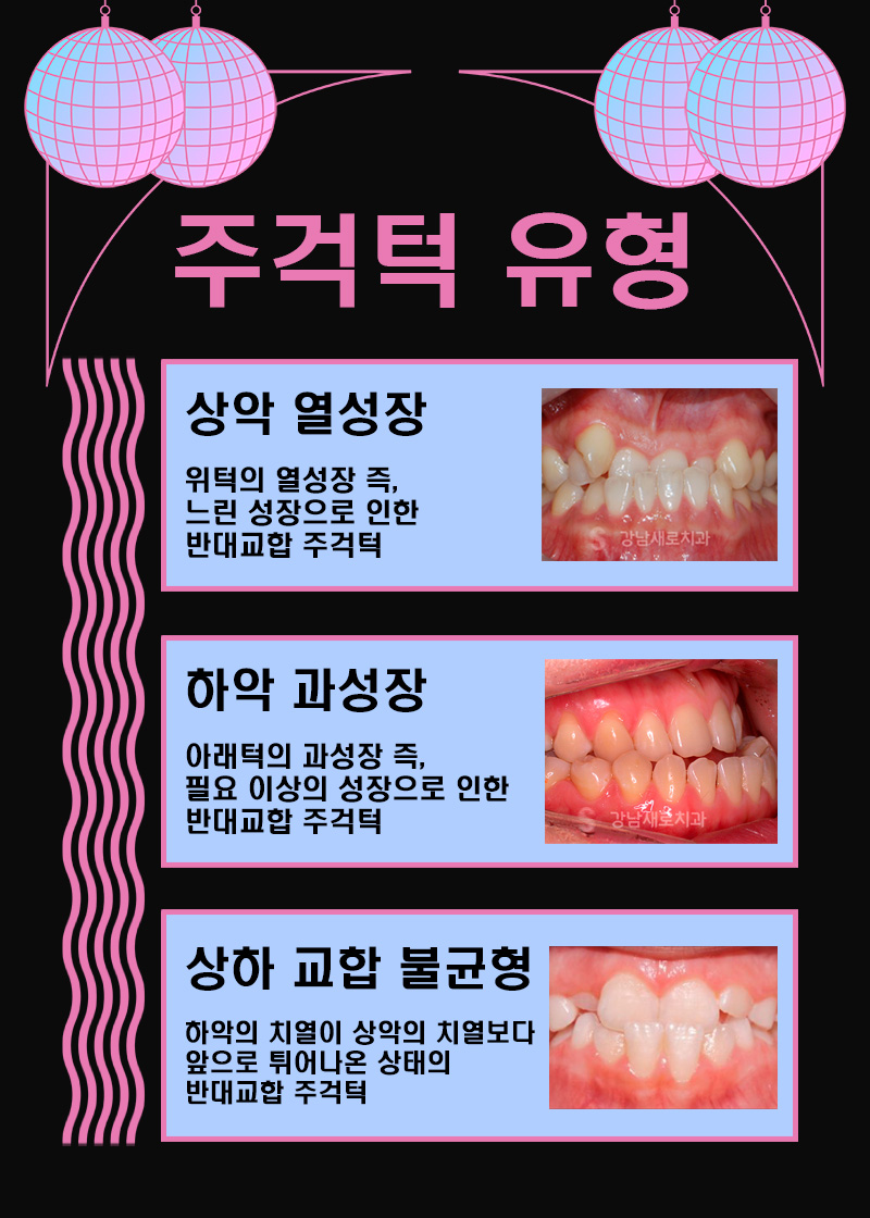 성인 주걱턱 수술 없이 비수술로 (성인 주걱턱교정) 관련 이미지 2