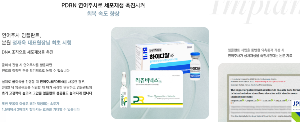 임플란트수술 이란? 부작용 최소화 하려면 반드시 알아야할 것 관련 이미지 10