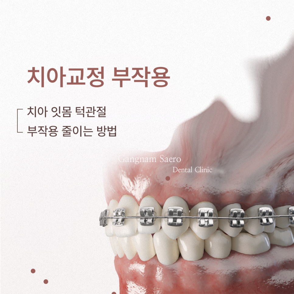 치아교정부작용 (치아, 잇몸, 턱관절) 부작용 줄이는 방법 관련 이미지 4