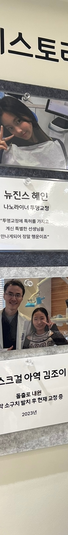 뻐드렁니교정치료, 돌출입을 단기간에 개선하는 방법? 관련 이미지 16