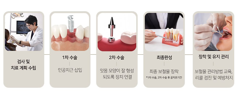 최소 통증으로 최대 효율 (임플란트통증) 관련 이미지 2