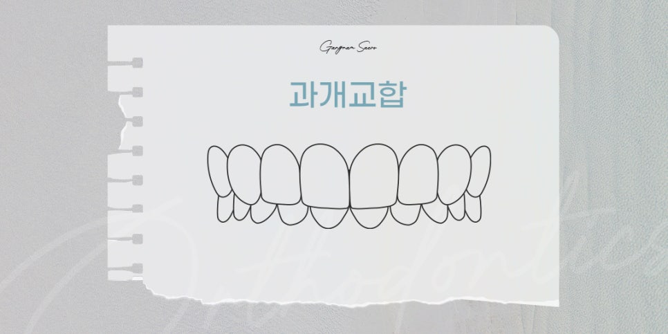 비수술 부정교합을 위한 치과 교정 (투명교정부정교합) 관련 이미지 8