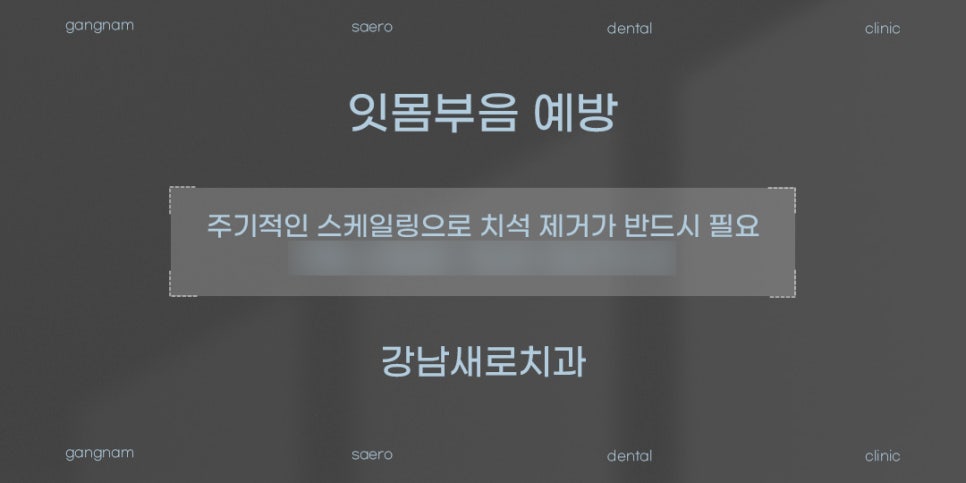 갑자기 잇몸이 부었다면? (잇몸부음원인 잇몸부음해결) 관련 이미지 5