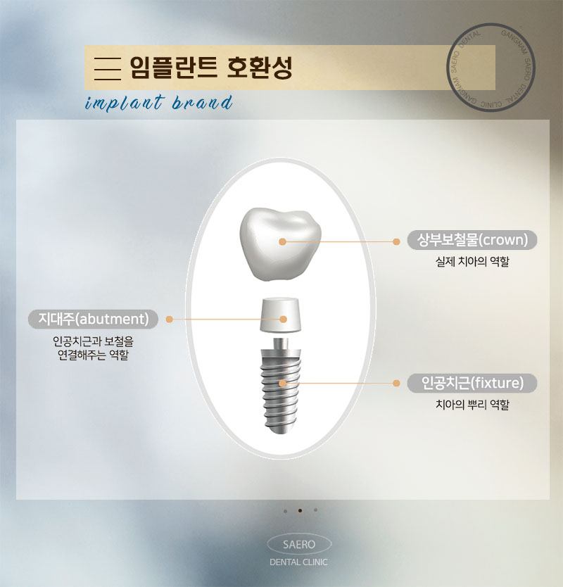 임플란트 종류 브랜드 선택 (임플란트회사) 관련 이미지 3