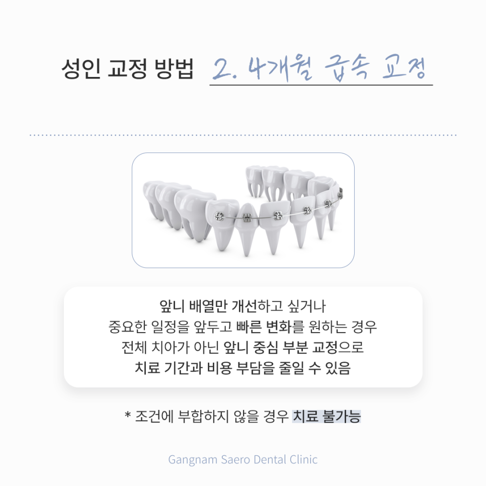 Adult Orthodontics: A Brighter Smile with Orthodontic Treatment in Your 20s and 30s image 4