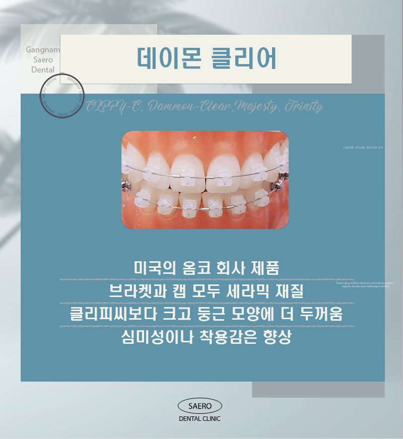 자가결찰교정과 클리피씨의 차이? (자가결찰교정 종류) 관련 이미지 4