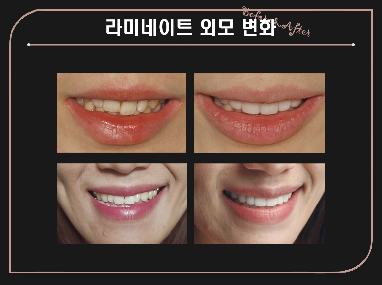 에어네이트의 예술성 (삭제 제로라미네이트) 관련 이미지 2