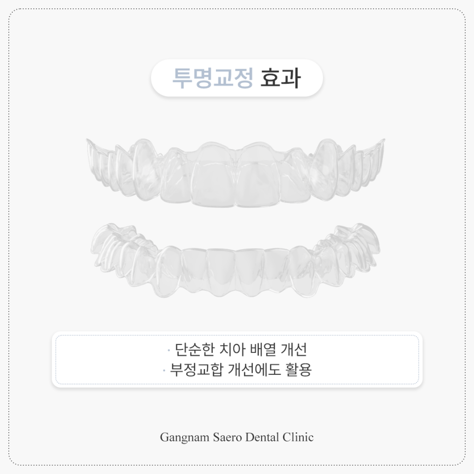투명교정효과 투명교정후기 투명교정전후 관련 이미지 2