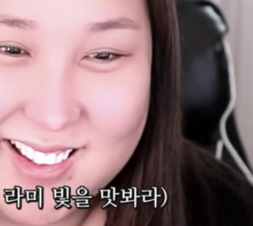 풍자 라미네이트? 치아 삭제 없는 과정으로 관련 이미지 2